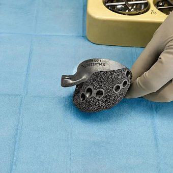 Врачи Сургута восстановили тазобедренный сустав с помощью 3D-импланта