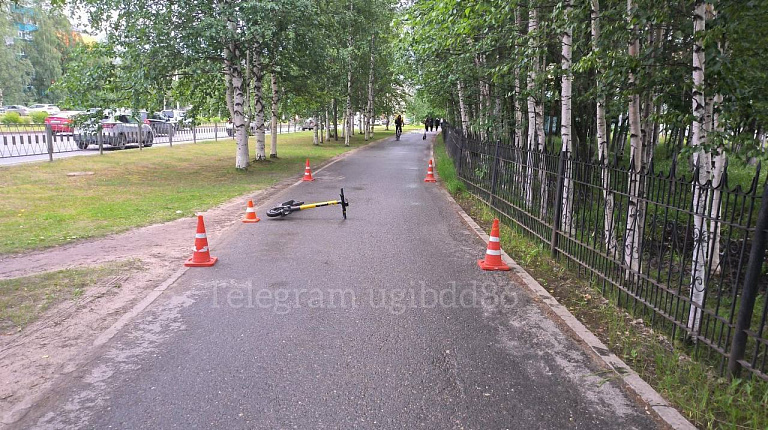 В Нижневартовске возбуждено уголовное дело после наезда электросамоката на ребенка